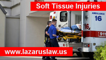 Soft Tissue Injuries are Painful and Slow to Heal - Fort Lauderdale Accident Lawyers