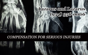 Compensation for Injuries