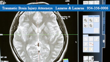 Traumatic Brain Injuries and Proper Long-Term Care
